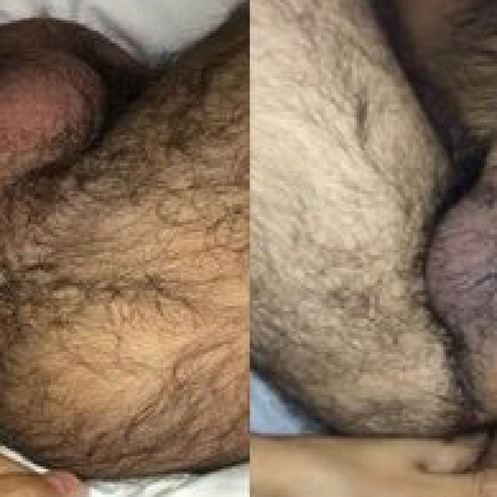 Hairy indian